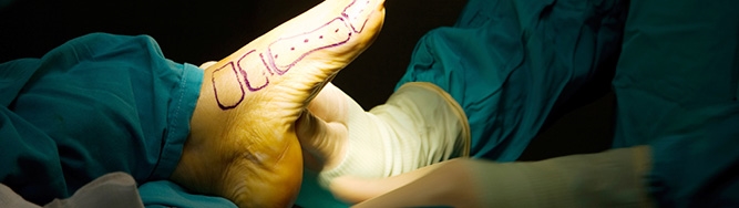 Foot surgery Foot surgery